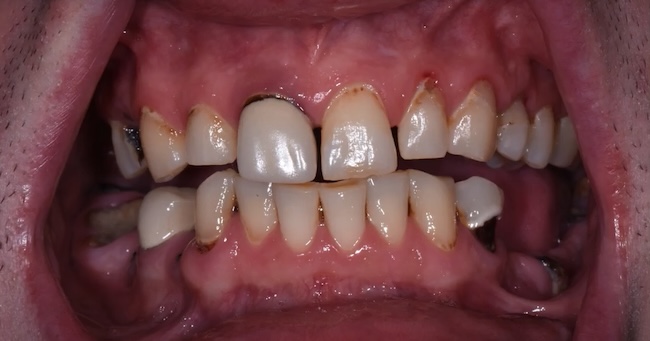 smile gallery image