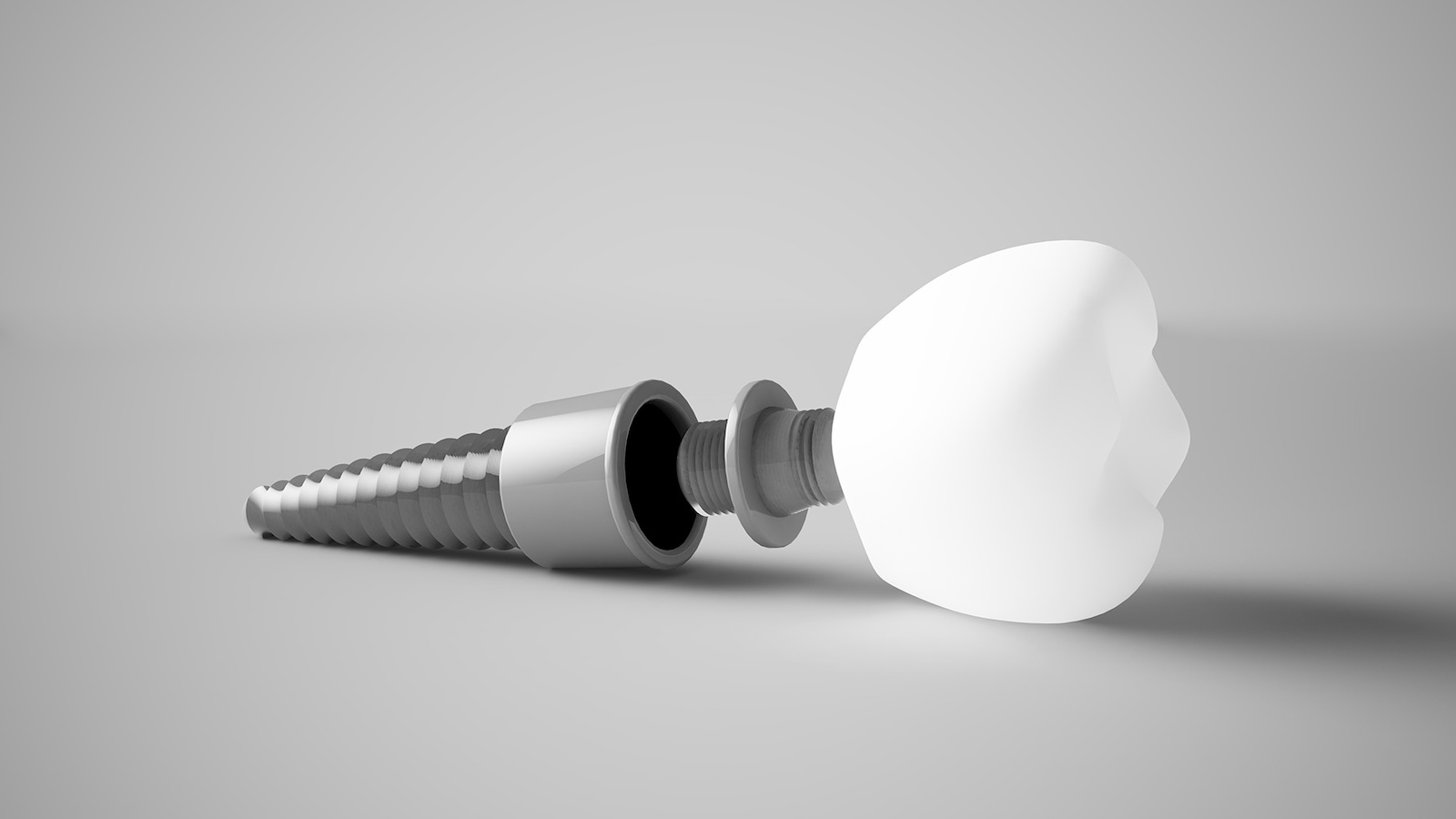 Dental Implants of Brooklyn NY