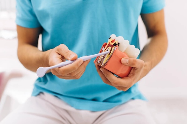Root Canal