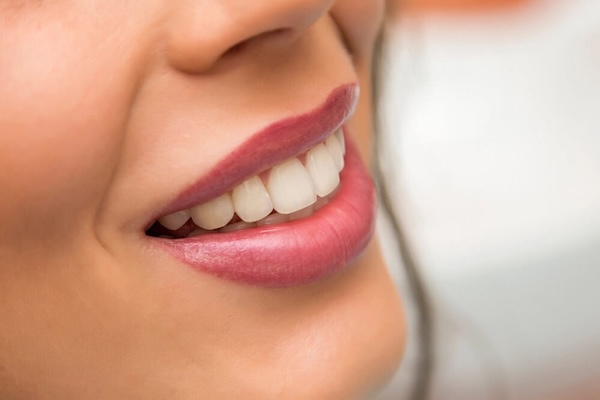 Smile restoration