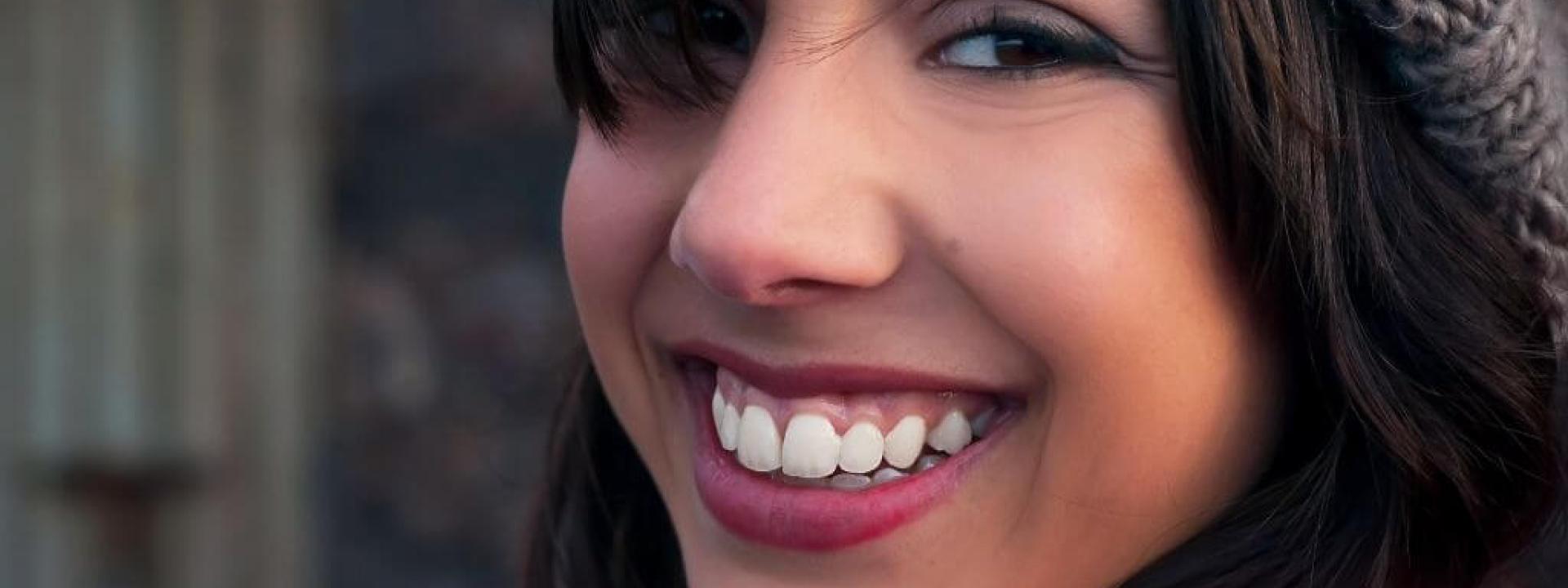 Gummy Smile Treatment