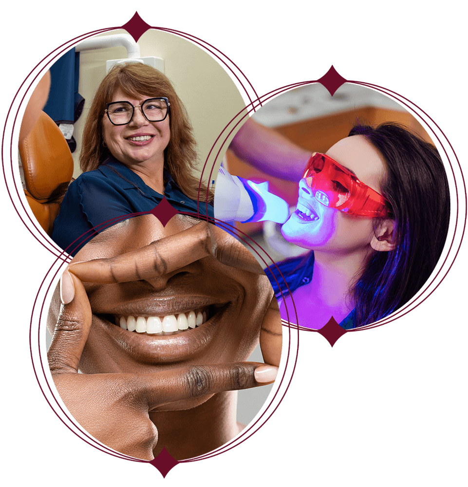 teeth whitening 3 tier