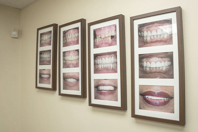 Always Beautiful Smile