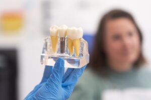 A gloved hand holds a dental model with three teeth, one featuring a metal implant. A blurred person is visible in the background, probably in a dental office.